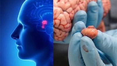 في جسم الانسان غدة تفرز تسعة هرمونات ..لو تعطل افراز هرمون واحد لاصبحت حياة الانسان جحيم ..فما هي؟