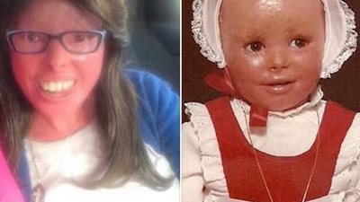 بنت من كنيسه مارجرجس هليوبليس ، مولوده بهذا التشوه و انتقلت للسماء بلا اسباب فى بيتها 1096283