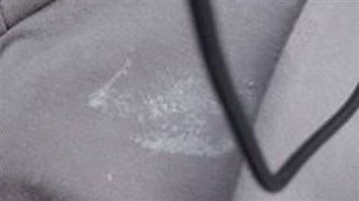 النهاردة و انا بركب الصبح من مريوطية رايحة الشغل ف المعادى .جت بنت وقفت جمبى و الدنيا كانت زحمة و ناس كتير اوى مره واحدة بحط إديا ع جمبى لقيت كريم او حاجه شبهه اوى ع هدومى 1103114