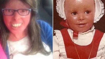 بنت من كنيسه مارجرجس هليوبليس ، مولوده بهذا التشوه و انتقلت للسماء بلا اسباب فى بيتها 1106399