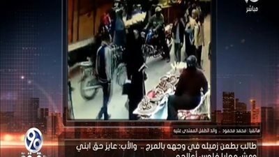 بالفيديو | مأساه طالب 13 سنه يطعن زميله في الوجه بالمرج مما استدعي 30 غرزه بالوجه وانفعال جيهان لبيب علي الهواء