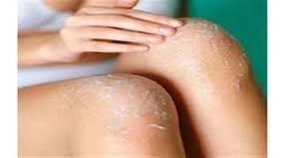 وصفات مجربه ستخلصك من سواد الكوع والركبتين