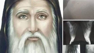 معجزة شفاء عجيبة للانبا كاراس مع سيدة بعد تمجيد له