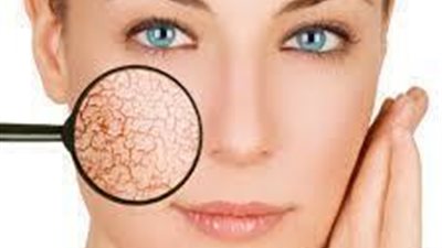 وداعا للبشره الجافه مرطب طبيعى للوجه