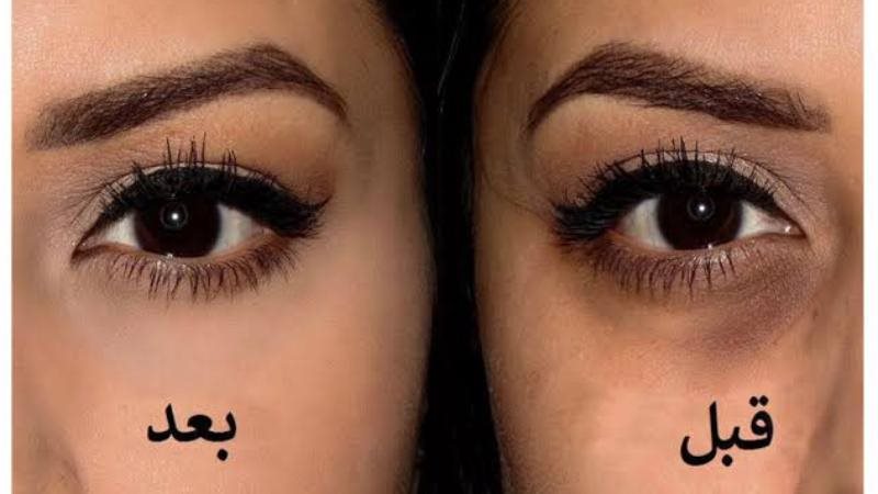 الحق والضلال