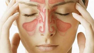 ​طرق مجربة لعلاج الجيوب الأنفية