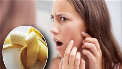 ٨ فوائد مذهله لقشر الموز لجمال البشره و الجلد