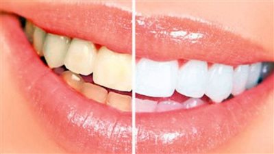 مشروبات تتسبب في اصفرار أسنانك ابتعد عنها فور ا