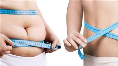 طرق وخطوات تركيب بالون المعدة للتخلص من السمنة