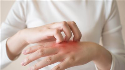 ما هو الحزام الناري و طريق علاجة