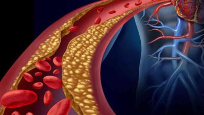 مشروبات تساعد علي خفض الكوليسترول