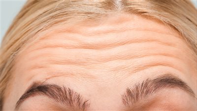 طرق طبيعية للتخلص من تجاعيد الجبهة تعرف عليها