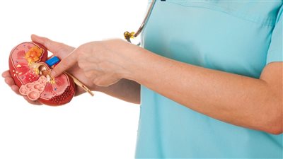 طرق طبيعية لعلاج حصوات الكلي