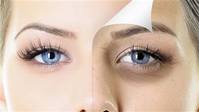 وصفات طبيعية للهالات السودة تحت العين