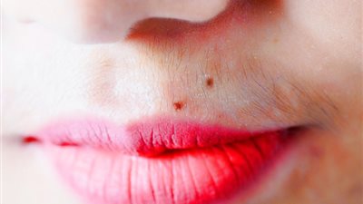 أسباب ظهور الشعر الزائد لدى السيدات+ معلومات خطيرة جدا