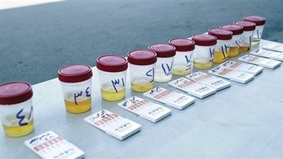 حفظ التحقيقات في اتهام مستشفى الشرطة بالتلاعب بتقارير المخدرات