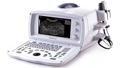 اغرب من الخيال تصوير بالموجات الصوتية لطفل يُظهِر وجود يسوع مُلتحٍ ويرتدي ثوبا وإكليلا من الشوك!!!