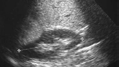 سيدة تحرر محضرا ضد طبيب لاكتشاف فوطة ببطنها