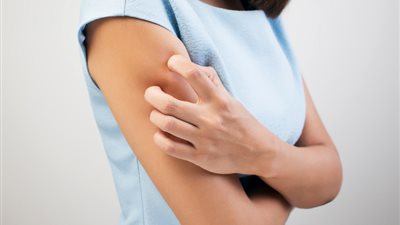 تعرف على 7 طرق طبيعية لعلاج الطفح الجلدى