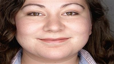 اعرف ازاى تتخلص من دهون الوجه بهذه الطريقة