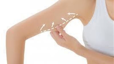 7 عادات يومية قد تسبب السيلوليت