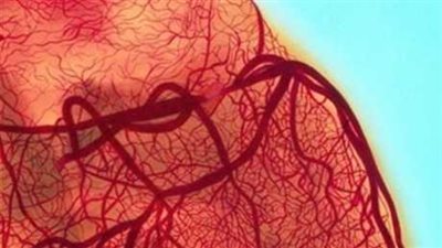 تعرف على نوع من الأجبان يصيبك بأمراض القلب