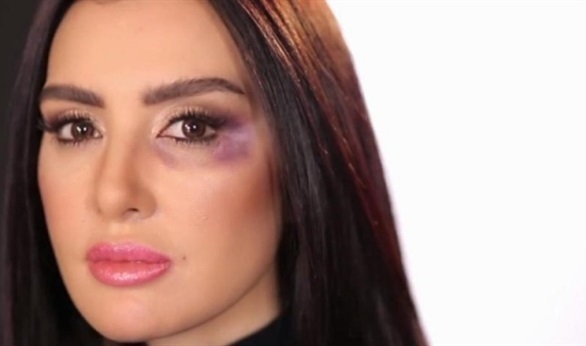 صور   ميساء مغربي تتعرض لإصابة خطيرة