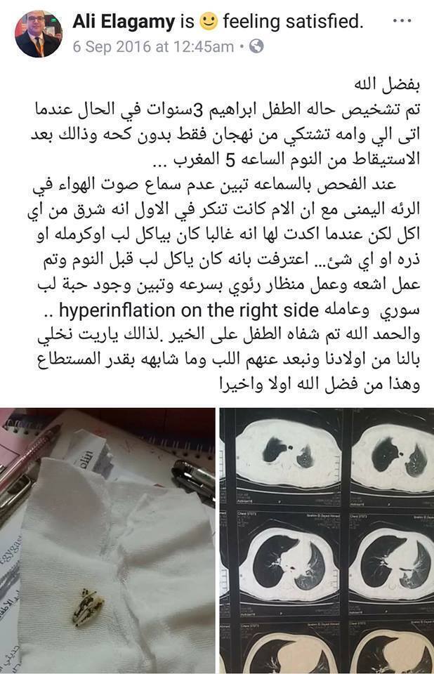 بالصور أطباء يحذرون الأمهات بشده قبل سن الخمس سنوات ممنوع هذه الأشياء تماما فانها قد تسبب وفاة الطفل