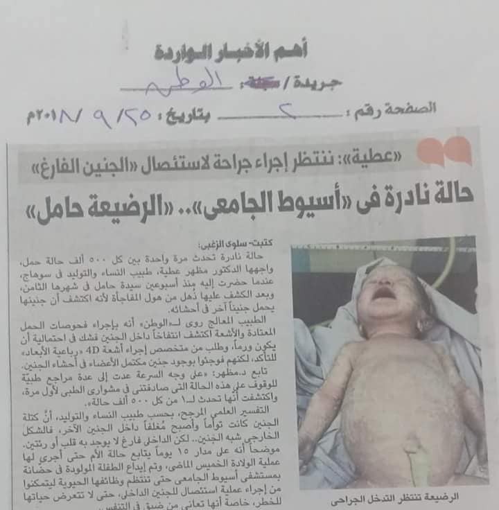 بالصور حاله نادره أغرب من الخيال داخل مستشفي أسيوط طفل رضيعه حامل في أختها    